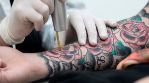 ¿Ganas de quitarte tus tatuajes? Aquí te explicaremos por qué el retiro de tatuajes con técnica láser es una de las mejores opciones para ti. retiro de tatuajes_clínica dermatológica isela méndez