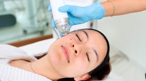 microagujas_clínica dermatológica isela méndez¿Ya conoces nuestro tratamiento con microagujas faciales? Su avanzada tecnología puede darle a tu piel el efecto renovador que necesita.