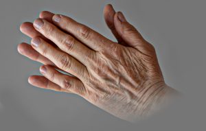 rejuvenecimiento de manos_clínica dermatológica isela méndez¿Sabías que existen tratamientos de rejuvenecimiento de manos? Aquí podrás ver cuáles son las mejores opciones para renovar esta zona tan visible de tu cuerpo.