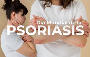 psoriasis_clínica dermatológica isela méndez
